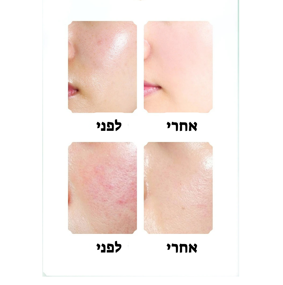 "AuraLift מכשיר טיפוח לפנים – מפחית קמטים, ממצק את העור, משפר את גוון הפנים ומחזיר זוהר טבעי ב־10 דקות ביום. מכשיר אלחוטי נייד עם ראשים מתחלפים לניקוי, פילינג, הספגת קרמים וטיפול בעיניים. מתאים לכל סוגי העור, עם משלוח חינם ואחריות מלאה."