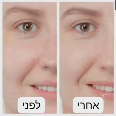 מברשת ניקוי פנים סונית ורודה מסיליקון עמידה במים IPX7.

אישה מנקה את פניה במברשת SonicGlow שחורה.

תקריב של מברשת חשמלית לעור הפנים עם הגנת עיניים.

הדגמת מצב חימום ועיסוי באזור העיניים.

מברשת פנים עמידה במים בשימוש באמבטיה.

מברשת פנים סגולה עם טעינה מגנטית.

הדמיה של ניקוי נקבוביות עמוק.

מברשת פנים סונית על רקע חדר אמבטיה יוקרתי.

תמונת סט מברשת + כבל טעינה.

תמונה של עיסוי פנים תרמי בעזרת מברשת סיליקון רכה.