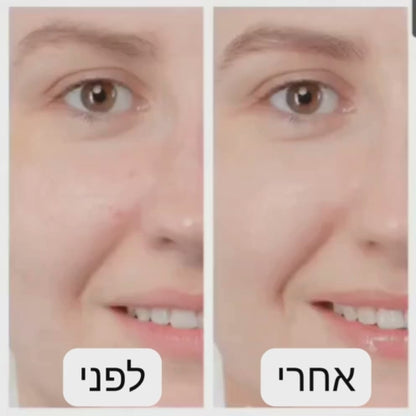 מברשת ניקוי פנים סונית ורודה מסיליקון עמידה במים IPX7.

אישה מנקה את פניה במברשת SonicGlow שחורה.

תקריב של מברשת חשמלית לעור הפנים עם הגנת עיניים.

הדגמת מצב חימום ועיסוי באזור העיניים.

מברשת פנים עמידה במים בשימוש באמבטיה.

מברשת פנים סגולה עם טעינה מגנטית.

הדמיה של ניקוי נקבוביות עמוק.

מברשת פנים סונית על רקע חדר אמבטיה יוקרתי.

תמונת סט מברשת + כבל טעינה.

תמונה של עיסוי פנים תרמי בעזרת מברשת סיליקון רכה.